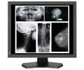 NEC 21.3IN WS LCD MONO 5MP 2560X2048 MED DIAG DISP MD215MG