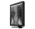 Eizo 21.3IN LCD MONO 2MP MEDICAL RADIFORCE GS220-CL-SH-N200D5DE NVIDIA Q2000D