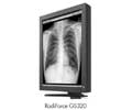Eizo 21.3IN LCD MONO 3MP MEDICAL RADIFORCE GS320-CL-SH-AV5805DE ATI MED-V5800