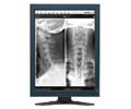 Eizo 21.3IN LCD MONO 2X2MP MED RADIFORCE GX220-CL-DH-AV4805DE ATI MED-V4800