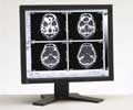 Eizo 18.1IN LCD MONO 600:1 1MP 1280X1024 RADIFORCE G11-BK BLACK