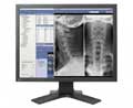 Eizo 21IN LCD COLOR 1600X1200 1000:1 MEDICAL MX210-BK BLK/GRY VGA DVI